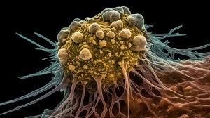 Clinical expertise cancer