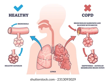 Clinical expertise copd